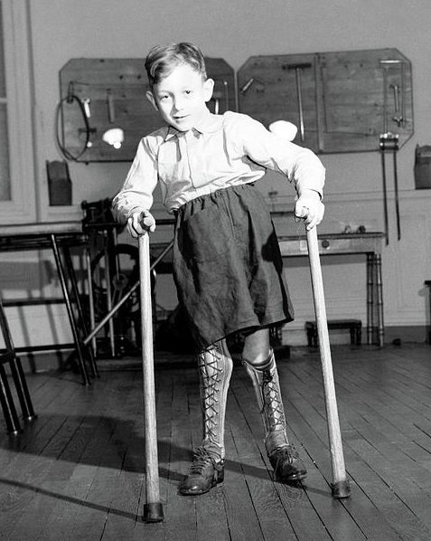 Kid who had Polio